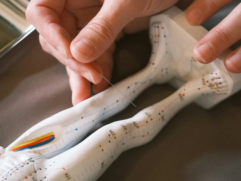 Acupuncture at Douglas DeSalvo Chiropractic, Inc. in NOVATO