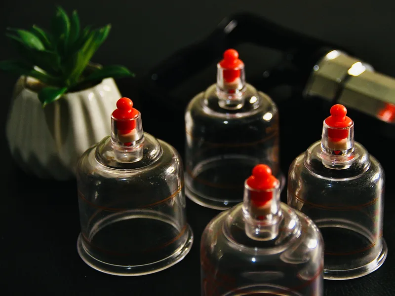 How Cupping Therapy works at Douglas DeSalvo Chiropractic, Inc.