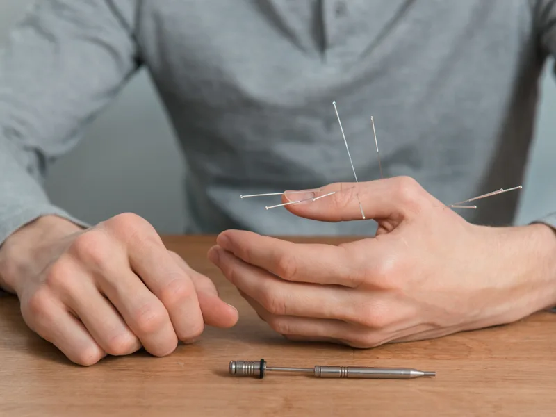 Dry Needling at Douglas DeSalvo Chiropractic, Inc. in NOVATO