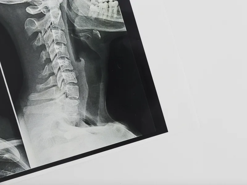 X-Rays at Douglas DeSalvo Chiropractic, Inc. in NOVATO